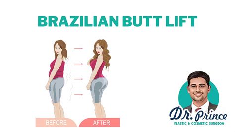 brazilian butt lift philippines